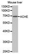 Acetylcholinesterase antibody, abx001246, Abbexa, Western Blot image 