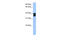 Solute Carrier Family 25 Member 31 antibody, 30-939, ProSci, Enzyme Linked Immunosorbent Assay image 