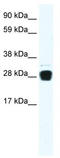 TNF Superfamily Member 12 antibody, TA330020, Origene, Western Blot image 