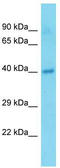 Transmembrane Protein 25 antibody, TA339626, Origene, Western Blot image 