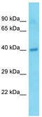 TMM25 antibody, TA339626, Origene, Western Blot image 