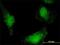 HSP13 antibody, H00006782-M02, Novus Biologicals, Immunocytochemistry image 