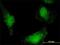 Heat Shock Protein Family A (Hsp70) Member 13 antibody, H00006782-M02, Novus Biologicals, Immunocytochemistry image 