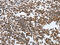 MutS Homolog 6 antibody, CSB-PA589405, Cusabio, Immunohistochemistry paraffin image 