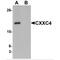 CXXC Finger Protein 4 antibody, MBS151049, MyBioSource, Western Blot image 