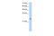 Alcohol Dehydrogenase 6 (Class V) antibody, A08835, Boster Biological Technology, Western Blot image 