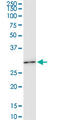 Homeobox C6 antibody, LS-C197442, Lifespan Biosciences, Western Blot image 