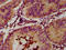 Eosinophil Peroxidase antibody, LS-C670109, Lifespan Biosciences, Immunohistochemistry paraffin image 