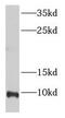 Elongation Factor 1 Homolog antibody, FNab02745, FineTest, Western Blot image 