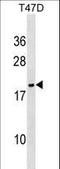 NME/NM23 Nucleoside Diphosphate Kinase 6 antibody, LS-C101175, Lifespan Biosciences, Western Blot image 