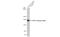 Platelet Derived Growth Factor Receptor Alpha antibody, GTX01102, GeneTex, Western Blot image 