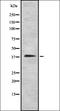 STEAP Family Member 1 antibody, orb337414, Biorbyt, Western Blot image 