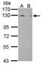 Lipin 1 antibody, PA5-30461, Invitrogen Antibodies, Western Blot image 