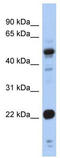 Cysteine And Glycine Rich Protein 1 antibody, TA335760, Origene, Western Blot image 