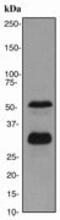 Lymphoid Enhancer Binding Factor 1 antibody, ab137872, Abcam, Western Blot image 