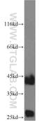 Cathepsin B antibody, 12216-1-AP, Proteintech Group, Western Blot image 
