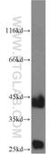 Cathepsin B1 antibody, 12216-1-AP, Proteintech Group, Western Blot image 