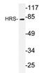 Hepatocyte Growth Factor-Regulated Tyrosine Kinase Substrate antibody, AP20247PU-N, Origene, Western Blot image 