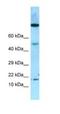 Odorant Binding Protein 2A antibody, NBP1-98584, Novus Biologicals, Western Blot image 