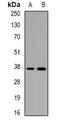 CD1a Molecule antibody, abx141314, Abbexa, Western Blot image 