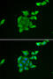 Opioid Growth Factor Receptor antibody, A06220, Boster Biological Technology, Western Blot image 