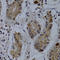 TNF Receptor Superfamily Member 6b antibody, A0649, ABclonal Technology, Immunohistochemistry paraffin image 