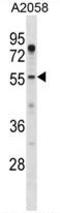 ASPSCR1 Tether For SLC2A4, UBX Domain Containing antibody, AP50277PU-N, Origene, Western Blot image 