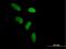 Zinc Finger Protein 433 antibody, H00163059-B01P, Novus Biologicals, Immunofluorescence image 