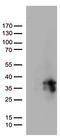 O-6-Methylguanine-DNA Methyltransferase antibody, LS-C798649, Lifespan Biosciences, Western Blot image 