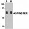 Protein spinster homolog 1 antibody, MBS153414, MyBioSource, Western Blot image 
