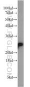 RNA Polymerase II Subunit E antibody, 15217-1-AP, Proteintech Group, Western Blot image 