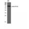 Tyrosine-protein kinase ITK/TSK antibody, LS-C381590, Lifespan Biosciences, Western Blot image 