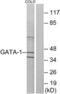GATA Binding Protein 1 antibody, LS-C118126, Lifespan Biosciences, Western Blot image 