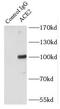 Angiotensin I Converting Enzyme 2 antibody, FNab00081, FineTest, Immunoprecipitation image 