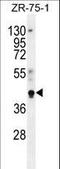 Pygopus Family PHD Finger 1 antibody, LS-C162340, Lifespan Biosciences, Western Blot image 