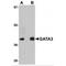 GATA Binding Protein 3 antibody, MBS150421, MyBioSource, Western Blot image 