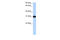 Muscleblind Like Splicing Regulator 2 antibody, 30-736, ProSci, Enzyme Linked Immunosorbent Assay image 