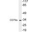 CD79a antibody, LS-C199804, Lifespan Biosciences, Western Blot image 