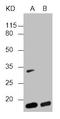 Hemoglobin Subunit Alpha 2 antibody, LS-C681796, Lifespan Biosciences, Western Blot image 