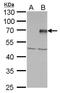 Protein Inhibitor Of Activated STAT 4 antibody, GTX110497, GeneTex, Western Blot image 