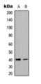 TNF Superfamily Member 8 antibody, orb393176, Biorbyt, Western Blot image 