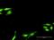 SNF8 Subunit Of ESCRT-II antibody, H00011267-D01P, Novus Biologicals, Immunocytochemistry image 