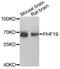 PHD Finger Protein 19 antibody, PA5-76335, Invitrogen Antibodies, Western Blot image 