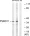 Proteasome 26S Subunit, Non-ATPase 11 antibody, abx014069, Abbexa, Western Blot image 