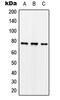 Synapsin I antibody, GTX32272, GeneTex, Western Blot image 