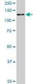 Cullin Associated And Neddylation Dissociated 1 antibody, H00055832-M02, Novus Biologicals, Western Blot image 