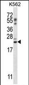 Psoriasis Susceptibility 1 Candidate 1 antibody, PA5-71794, Invitrogen Antibodies, Western Blot image 