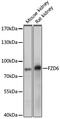 Frizzled Class Receptor 6 antibody, GTX64757, GeneTex, Western Blot image 