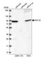 DEAD-Box Helicase 18 antibody, HPA041056, Atlas Antibodies, Western Blot image 