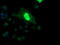 ETS Proto-Oncogene 2, Transcription Factor antibody, M02641, Boster Biological Technology, Immunofluorescence image 